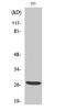 BRMS1 Transcriptional Repressor And Anoikis Regulator antibody, STJ91892, St John