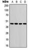 Glutamic-Oxaloacetic Transaminase 1 antibody, orb213988, Biorbyt, Western Blot image 