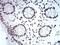 Chromobox 5 antibody, NBP2-52420, Novus Biologicals, Immunohistochemistry paraffin image 