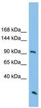 Rho GTPase Activating Protein 30 antibody, TA334958, Origene, Western Blot image 