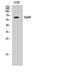 Erythropoietin Receptor antibody, STJ92962, St John