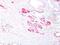 Alpha-Methylacyl-CoA Racemase antibody, NBP2-48130, Novus Biologicals, Immunohistochemistry paraffin image 
