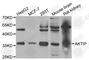 AKT Interacting Protein antibody, A6239, ABclonal Technology, Western Blot image 