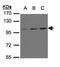 Glutamate Metabotropic Receptor 6 antibody, GTX108234, GeneTex, Western Blot image 