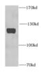 Hepatoma-derived growth factor-related protein 2 antibody, FNab04012, FineTest, Western Blot image 