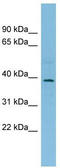 Tribbles homolog 3 antibody, TA344735, Origene, Western Blot image 