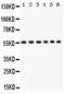 CD8 antibody, LS-C357418, Lifespan Biosciences, Western Blot image 