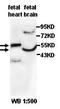 3-Oxoacid CoA-Transferase 1 antibody, orb77768, Biorbyt, Western Blot image 