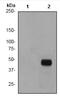 Glycogen Synthase Kinase 3 Beta antibody, ab75814, Abcam, Western Blot image 