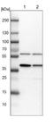 Pre-MRNA Processing Factor 18 antibody, NBP1-92297, Novus Biologicals, Western Blot image 
