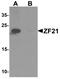 Zinc Finger FYVE-Type Containing 21 antibody, TA326630, Origene, Western Blot image 