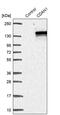 Codanin 1 antibody, PA5-59299, Invitrogen Antibodies, Western Blot image 