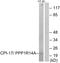 Protein Phosphatase 1 Regulatory Inhibitor Subunit 14A antibody, LS-C118085, Lifespan Biosciences, Western Blot image 