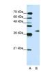 Adenosine Deaminase TRNA Specific 1 antibody, NBP1-57220, Novus Biologicals, Western Blot image 