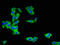 Gamma-Butyrobetaine Hydroxylase 1 antibody, LS-C673611, Lifespan Biosciences, Immunofluorescence image 