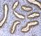 Fms Related Tyrosine Kinase 3 antibody, A00188-3, Boster Biological Technology, Immunohistochemistry paraffin image 