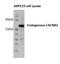 Calcium Voltage-Gated Channel Auxiliary Subunit Beta 2 antibody, H00000783-M05, Novus Biologicals, Western Blot image 