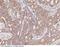 TNF Receptor Superfamily Member 6b antibody, 102431-T10, Sino Biological, Immunohistochemistry frozen image 