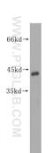 Mitogen-Activated Protein Kinase 11 antibody, 17376-1-AP, Proteintech Group, Western Blot image 