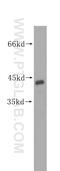 Mitogen-activated protein kinase 11 antibody, 17376-1-AP, Proteintech Group, Western Blot image 