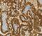 Chordin Like 2 antibody, MBS2523242, MyBioSource, Immunohistochemistry paraffin image 