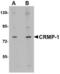 Collapsin Response Mediator Protein 1 antibody, TA306707, Origene, Western Blot image 