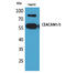 Carcinoembryonic Antigen Related Cell Adhesion Molecule 1 antibody, A00923-1, Boster Biological Technology, Western Blot image 