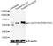 p56-LCK antibody, AP0491, ABclonal Technology, Western Blot image 