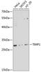 TIMP Metallopeptidase Inhibitor 1 antibody, GTX64360, GeneTex, Western Blot image 