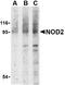 Nucleotide Binding Oligomerization Domain Containing 2 antibody, LS-B2720, Lifespan Biosciences, Western Blot image 