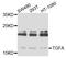 Transforming Growth Factor Alpha antibody, LS-B14370, Lifespan Biosciences, Western Blot image 