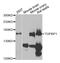 DNA Topoisomerase II Binding Protein 1 antibody, MBS2527914, MyBioSource, Western Blot image 