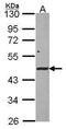 Serine/Threonine Kinase 17a antibody, GTX107969, GeneTex, Western Blot image 