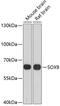SRY-Box 9 antibody, 18-660, ProSci, Western Blot image 