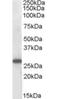 Suppressor Of Cytokine Signaling 3 antibody, orb18397, Biorbyt, Western Blot image 
