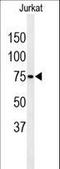 Poly(A) Specific Ribonuclease Subunit PAN3 antibody, LS-C163353, Lifespan Biosciences, Western Blot image 