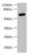 Family With Sequence Similarity 149 Member B1 antibody, CSB-PA839295LA01HU, Cusabio, Western Blot image 
