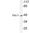 Serpin Family E Member 1 antibody, NBP1-19773, Novus Biologicals, Western Blot image 