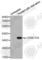 Cyclin Dependent Kinase 6 antibody, AP0289, ABclonal Technology, Western Blot image 