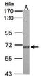 Kallikrein B1 antibody, GTX118926, GeneTex, Western Blot image 