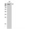 DCC Netrin 1 Receptor antibody, LS-C383090, Lifespan Biosciences, Western Blot image 