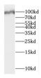 Dimethylglycine Dehydrogenase antibody, FNab02424, FineTest, Western Blot image 