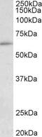 HIC ZBTB Transcriptional Repressor 2 antibody, PA5-37931, Invitrogen Antibodies, Western Blot image 