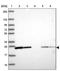 RAB1A, Member RAS Oncogene Family antibody, PA5-63254, Invitrogen Antibodies, Western Blot image 