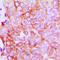 ADAM Metallopeptidase With Thrombospondin Type 1 Motif 7 antibody, orb234998, Biorbyt, Immunohistochemistry paraffin image 