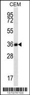 Follistatin Like 3 antibody, 56-333, ProSci, Western Blot image 