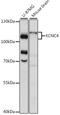 Potassium Voltage-Gated Channel Subfamily C Member 4 antibody, A15682, ABclonal Technology, Western Blot image 