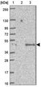 Armadillo Repeat Containing X-Linked 3 antibody, NBP1-89143, Novus Biologicals, Western Blot image 
