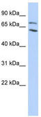 Metastasis-associated protein MTA2 antibody, TA339100, Origene, Western Blot image 