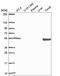 Retinoid X Receptor Beta antibody, HPA063653, Atlas Antibodies, Western Blot image 